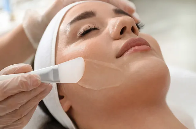 Kjemisk peeling