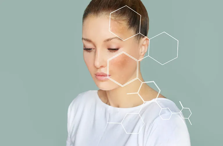PRX-T33 kjemisk peeling
